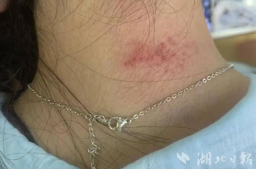 皮肤病.jpg